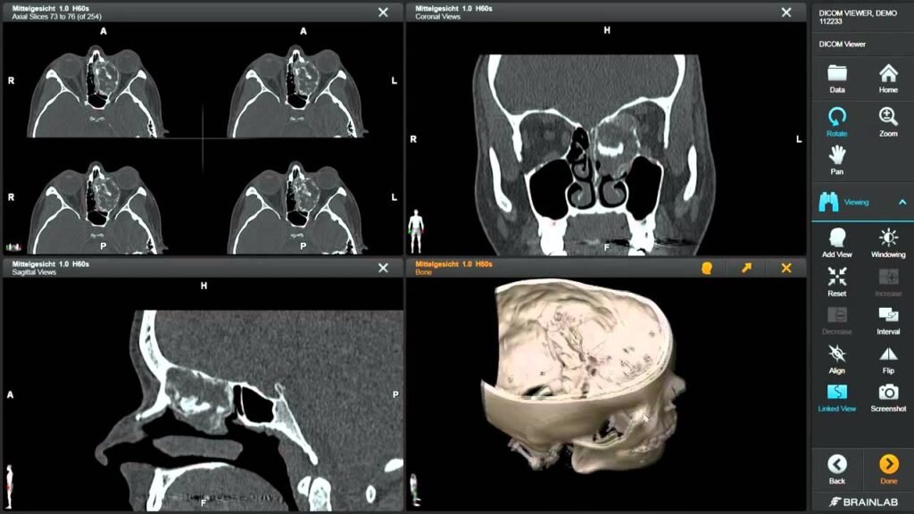 DICOM viewer Windows 10